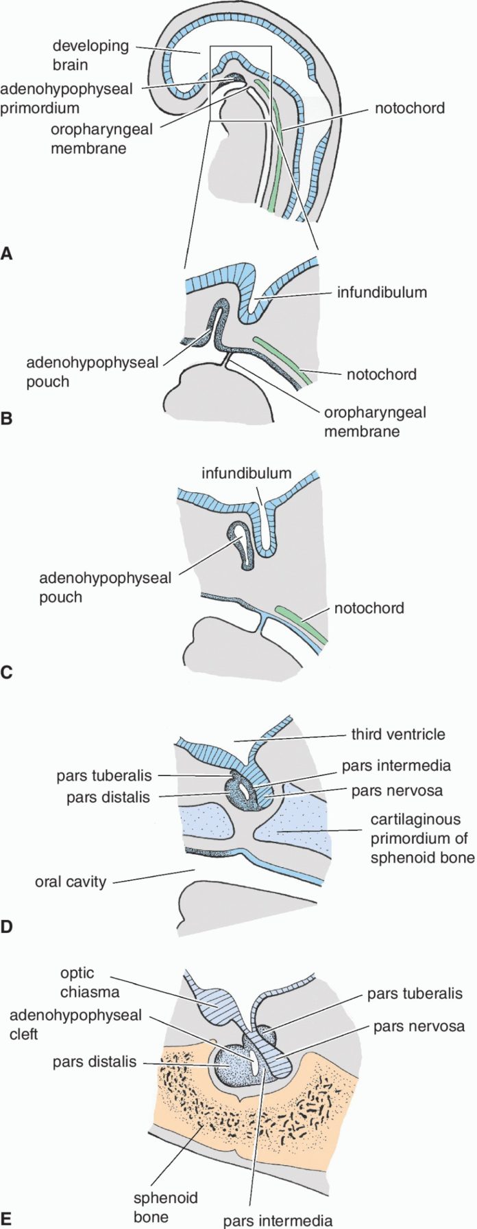 Pituitary Tumors Are Not Brain Tumors Pituitary World News 3345